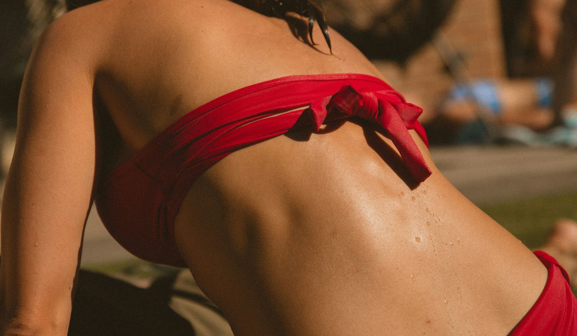 treat sunburn