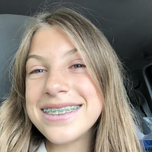Millie Coombes