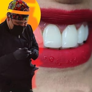 Cm Derhoz