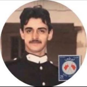 Rheumatoid Arthritis