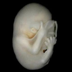 Douglas Vanlaningham