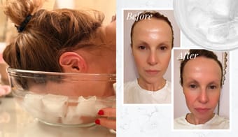 “I Tried The Celebrity Face Icing Craze For  Week – Here’s What It Did To My Skin”